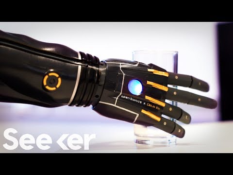 Engineers Created A New Bionic Arm That Can Grow With You