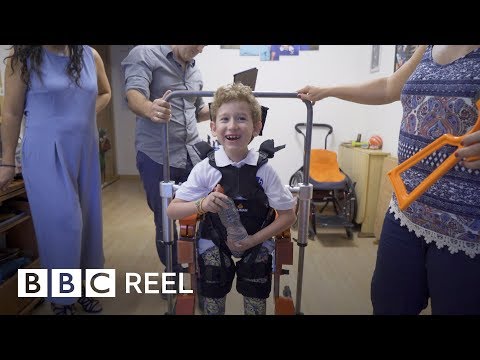The boy with the robot body – BBC REEL
