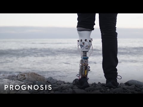 This MIT Engineer Built His Own Bionic Leg