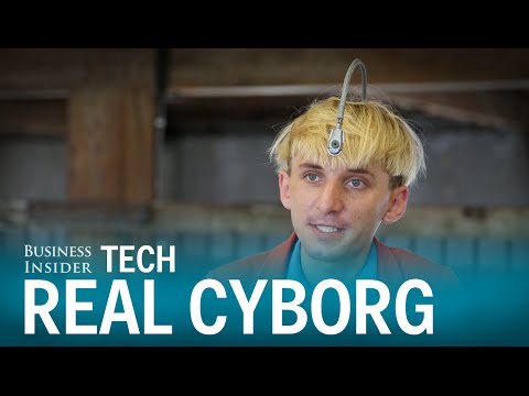 This real-life cyborg has an antenna implanted into his skull
